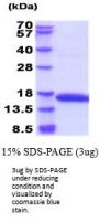 Rat Profilin 1 Recombinant Protein