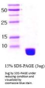Human ubiquitin Recombinant Protein