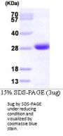 Human GRB2 Recombinant Protein