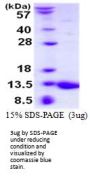 Mouse S100A5 Recombinant Protein