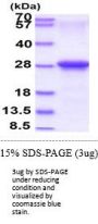 Human CXADR Recombinant Protein