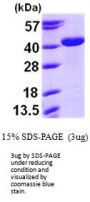 Human Arginase 2/ARG2 Recombinant Protein