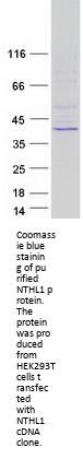 NTH1 (NTHL1) (NM_002528) Human Recombinant Protein
