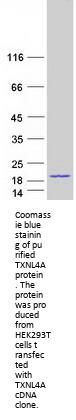 TXNL4A (NM_006701) Human Recombinant Protein