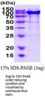 Mouse Neuropilin-1 Recombinant Protein