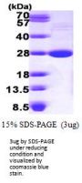 Mouse LYPLA1 Recombinant Protein