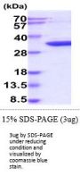 Human CDK5 Recombinant Protein
