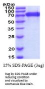 Mouse gp130/IL-6R beta Recombinant Protein