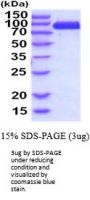 Mouse Angiopoietin-1 receptor Recombinant Protein