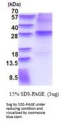 Human EVI-1 Recombinant Protein