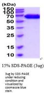 Mouse EphA4 Recombinant Protein