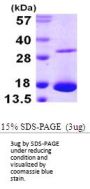 Human Galectin-10 Recombinant Protein