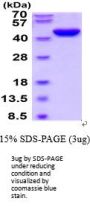 Mouse Serpin E2/PN1 Recombinant Protein