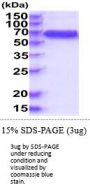 Human IL-10 R beta Recombinant Protein