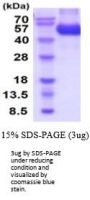 Rat CNTF R alpha Recombinant Protein