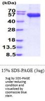 Human CD161 Recombinant Protein