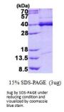 Human TDP-43/TARDBP Recombinant Protein