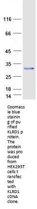 CD94 (KLRD1) (NM_002262) Human Recombinant Protein
