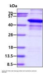 Human p62/SQSTM1 Recombinant Protein