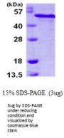 Human RCN2 Recombinant Protein