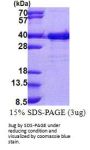 Human EMC2 Recombinant Protein