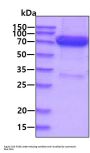 Human RAGE Recombinant Protein