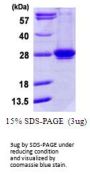 Human RAB35 Recombinant Protein