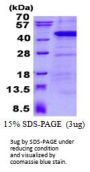 Human ANKRD1 Recombinant Protein