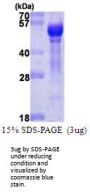 Human Angiopoietin-1 Recombinant Protein