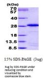 Human SPA17 Recombinant Protein