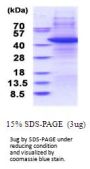 Human TARBP2 Recombinant Protein