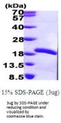 Human UBE2V2 Recombinant Protein