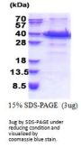 Human IGFBP-rp1/IGFBP-7 Recombinant Protein