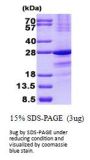 Human SSX1 Recombinant Protein