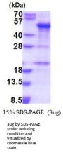 Human SNAPC1 Recombinant Protein