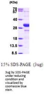 Human HIF-1 alpha Recombinant Protein