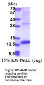 Human MIA Recombinant Protein