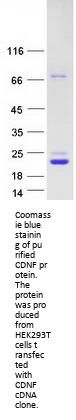 ARMETL1 (CDNF) (NM_001029954) Human Recombinant Protein