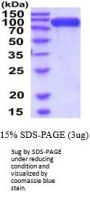 Rat ACE-2 Recombinant Protein