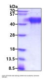 Mouse HAVcr-1/TIM-1/KIM-1 Recombinant Protein