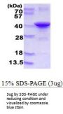 Human LDLRAP1 Recombinant Protein