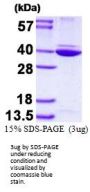Human Annexin A8-like Recombinant Protein 1/ANXA8L2 Recombinant Protein