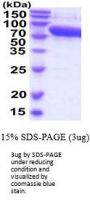 Mouse Serpin F2/alpha 2-Antiplasmin Recombinant Protein