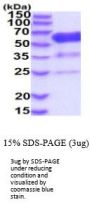 Mouse 5'-Nucleotidase/CD73 Recombinant Protein