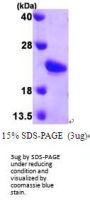 Mouse Sonic Hedgehog/Shh Recombinant Protein