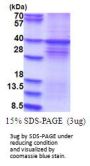 Rat DYRK1A Recombinant Protein