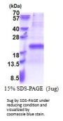 Human TXNRD3NB Recombinant Protein