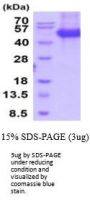 Human SFRP4 Recombinant Protein