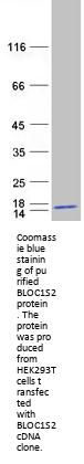 BLOC1S2 (NM_001001342) Human Recombinant Protein