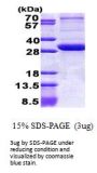 Human PEX26 Recombinant Protein